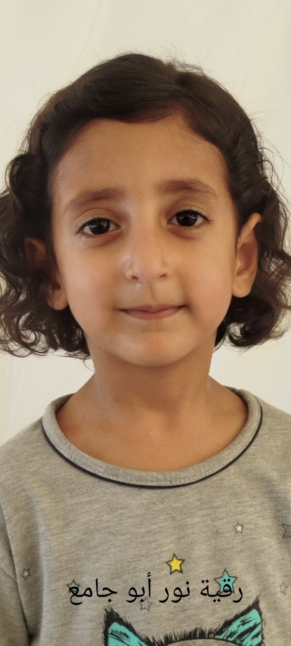 رقية