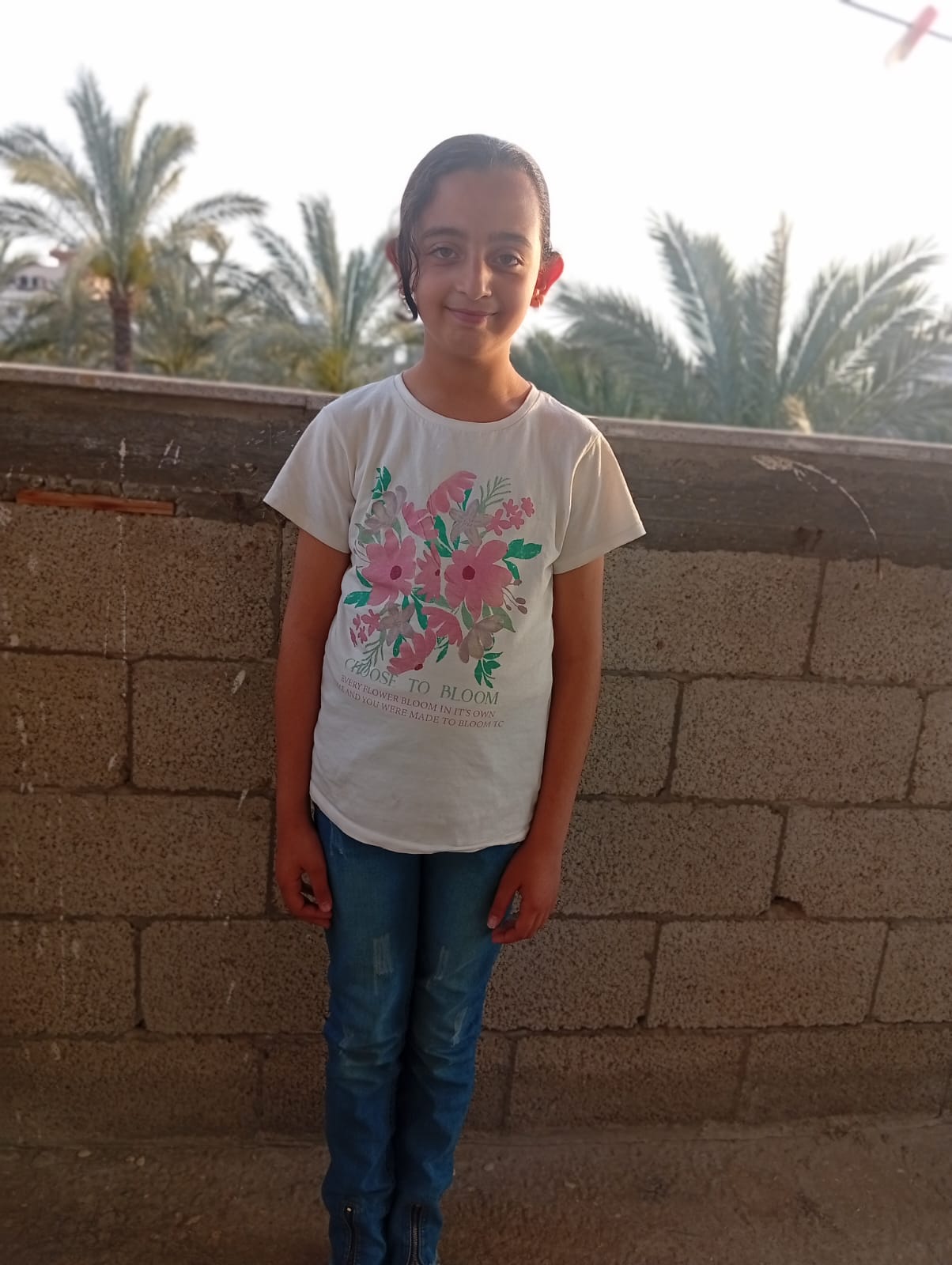 شامة 